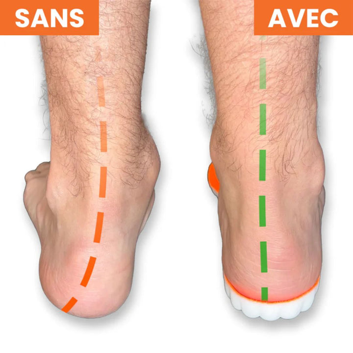 TDS - Pro™ - Semelles Orthopédiques - OrthoSoutien